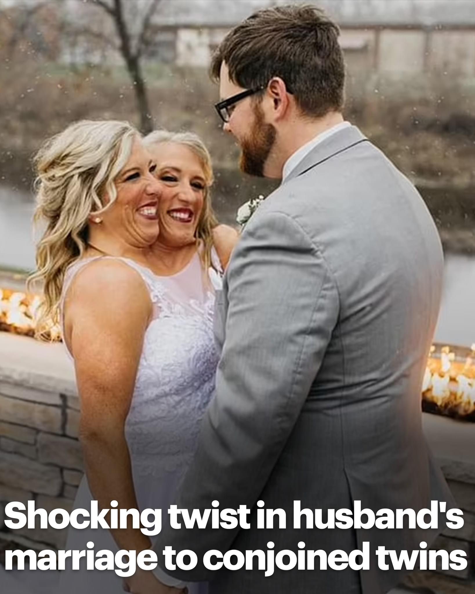 Conjoined twin’s husband slapped with paternity suit by woman he had kids with two years before marrying Abby Hensel