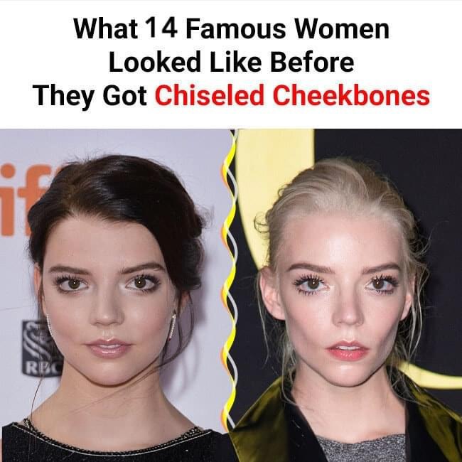 14 Famous People Before and After Getting Chiseled Cheek Bones
