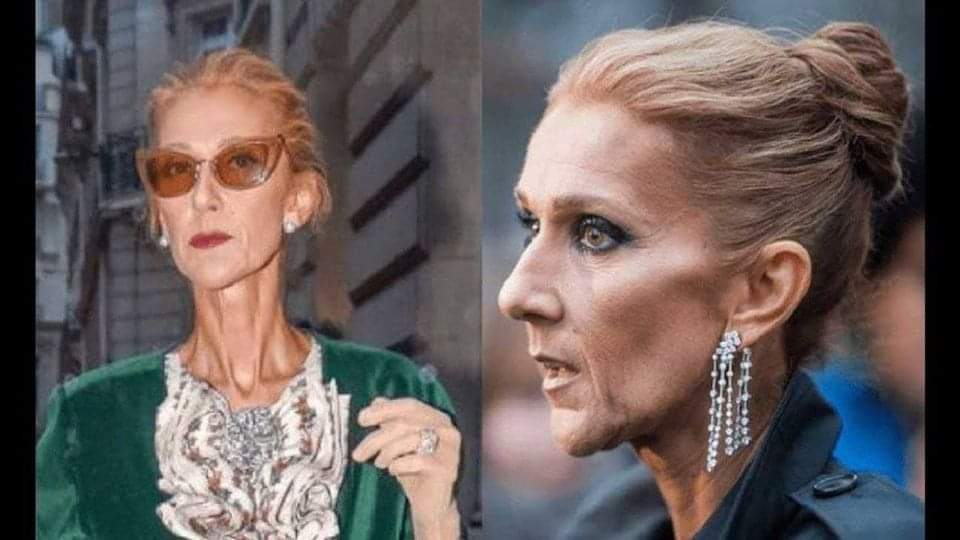 Celine Dion Reveals Her Problem