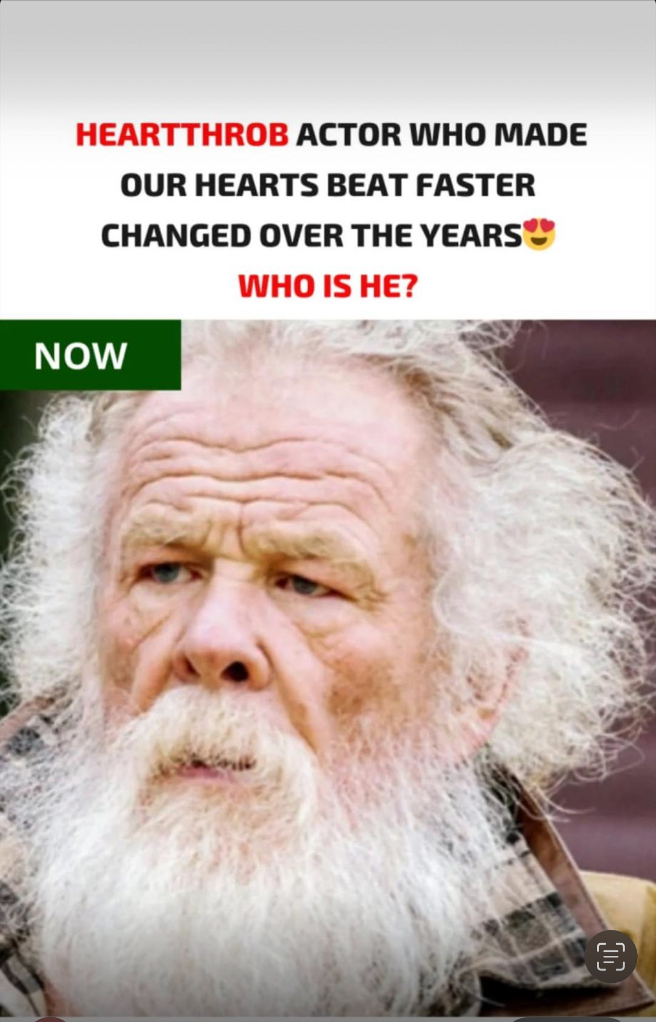 Leading parts are what this Hollywood hottie is known for. The 83-year-old actor is no longer recognisable.