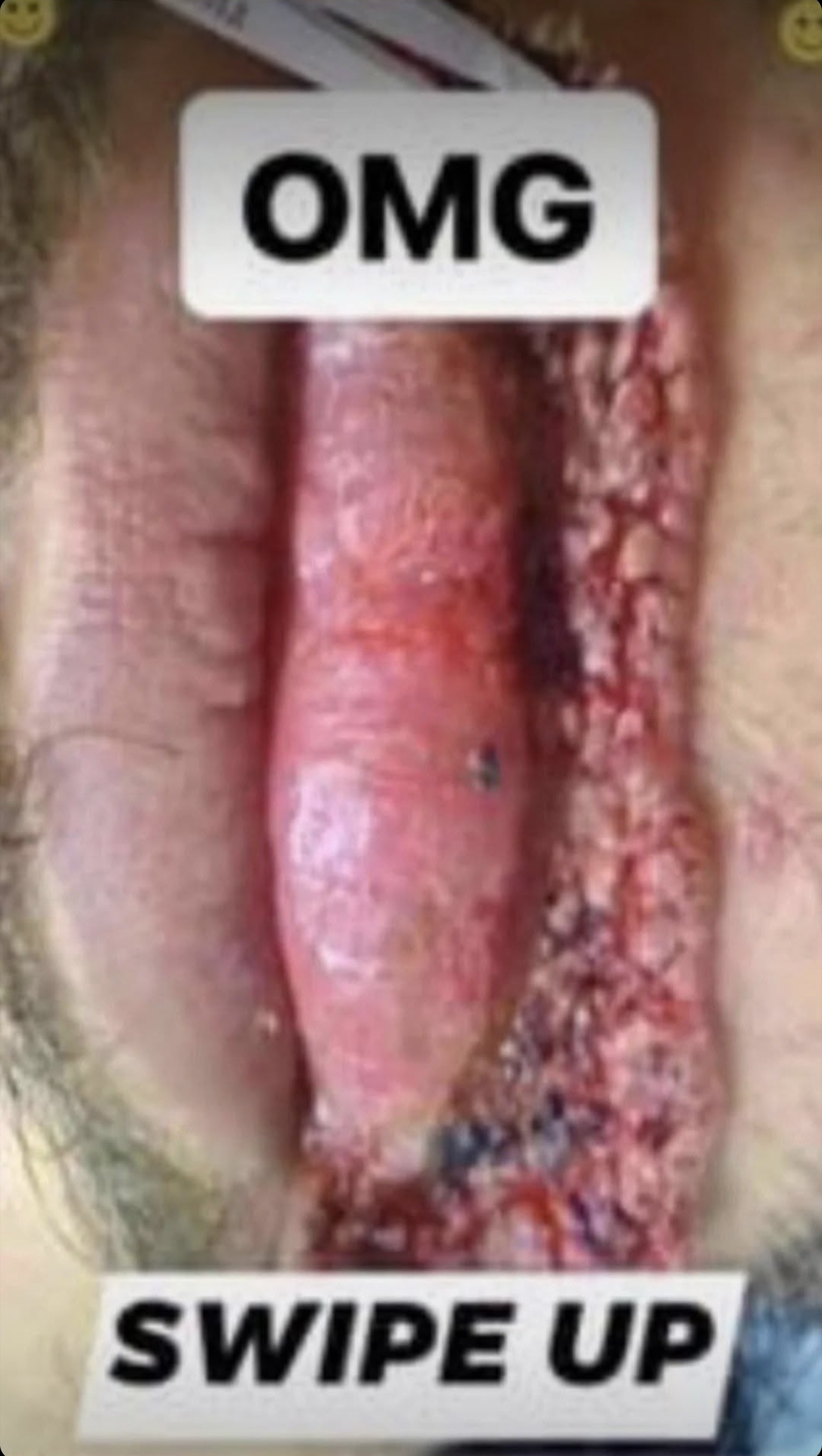 If you notice these signs on your body, consult a doctor immediately