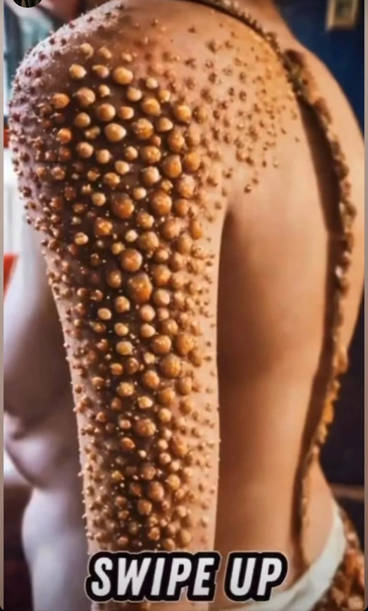 10 Signs Showing Something Is Wrong in Your Body