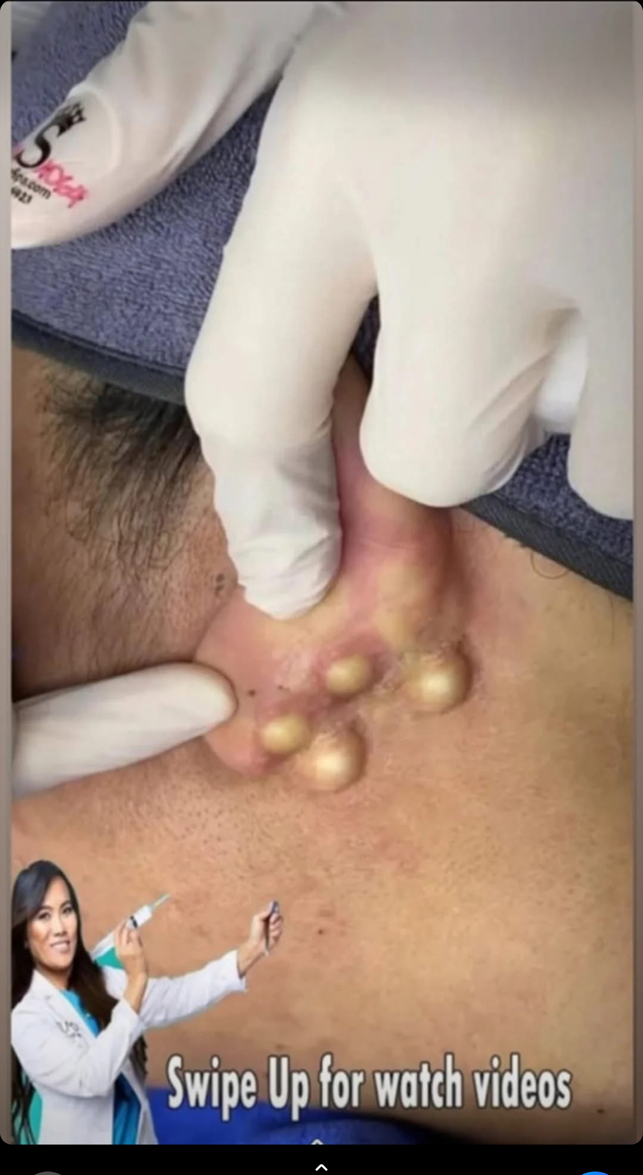 Five Psoriasis Warning Signs You Must Not Ignore