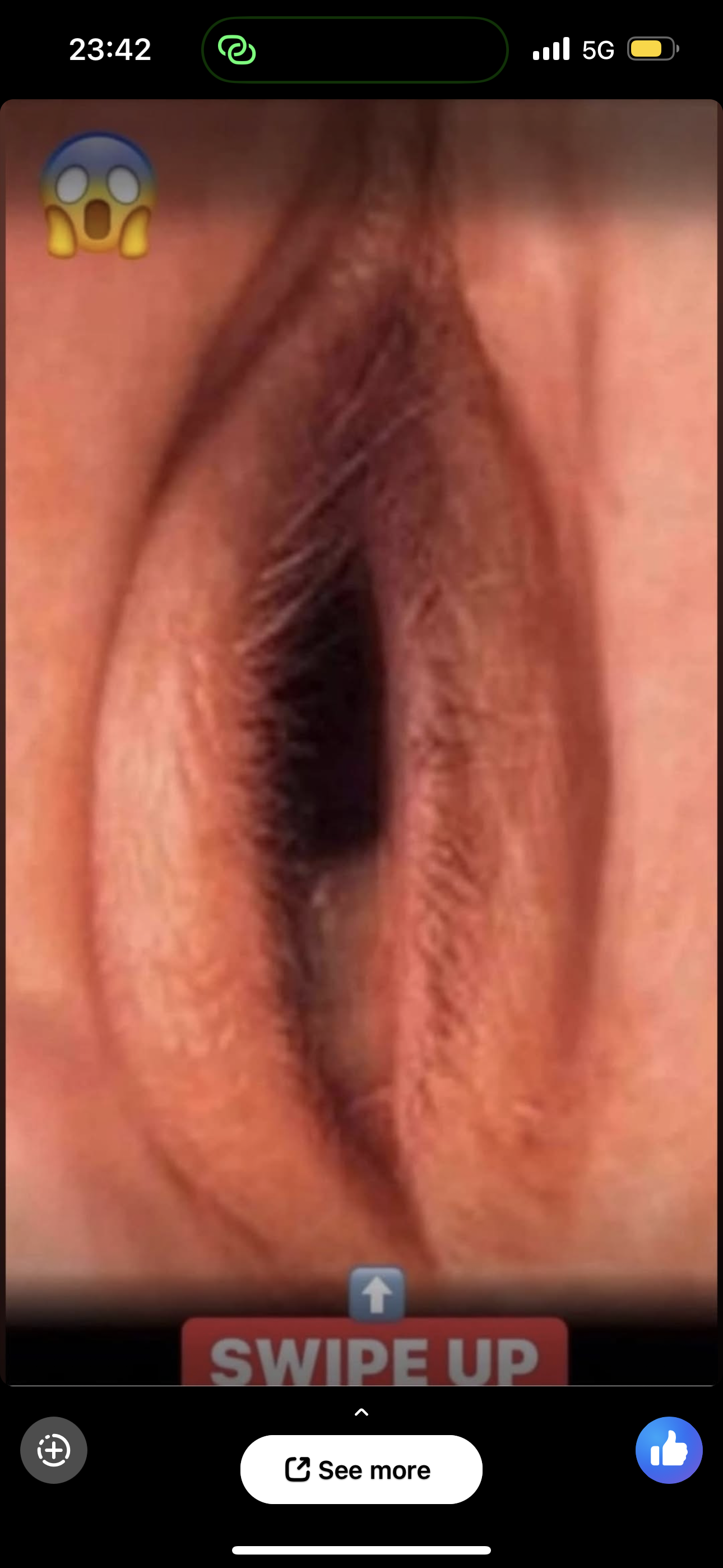 Skin Signals Used to Diagnose Serious Diseases