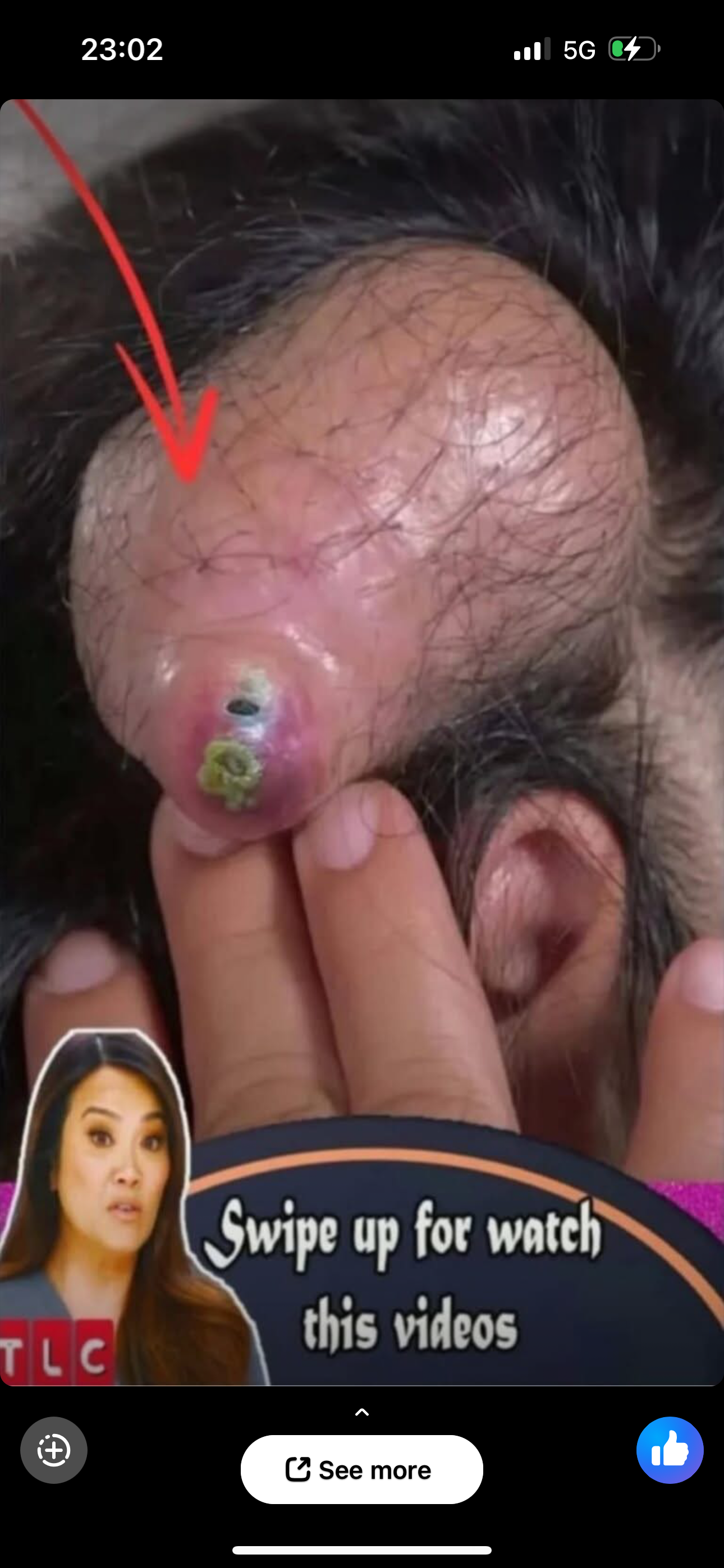 Managing Body Acne: 10 Effective Tips