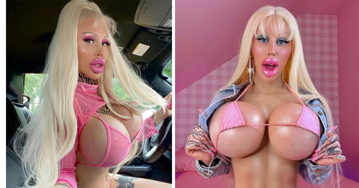 Swedish ‘Barbie’ spent over $120k on her body, reveals what she looked like before