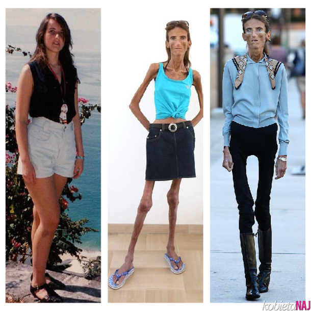 THE WORLD’S THINNEST WOMAN’S